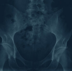 Various – Antipodean Anomalies 2